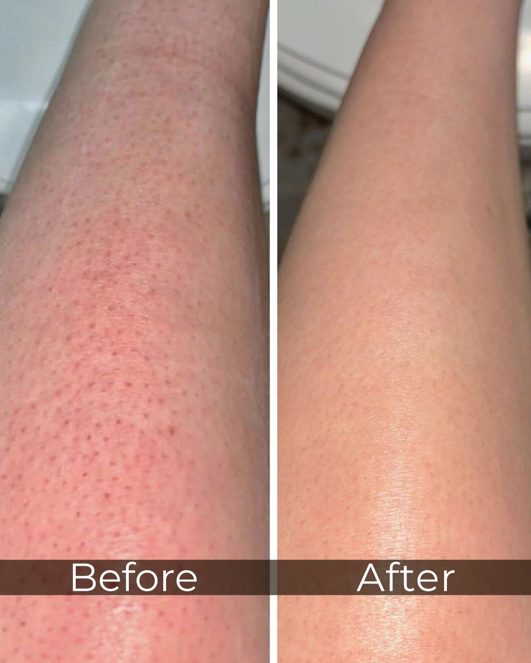 زيت تجديد الجسم