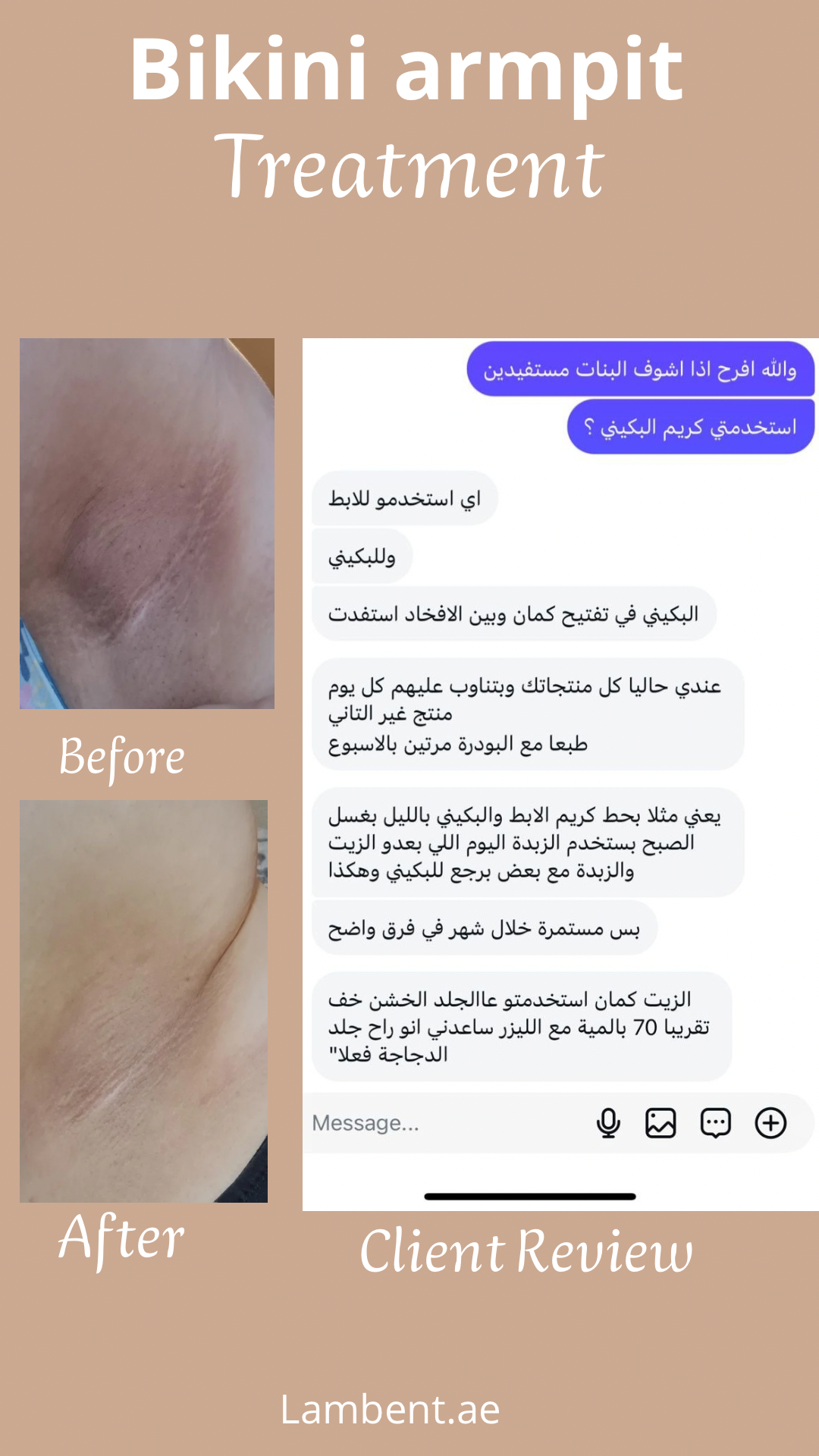 Bikini Armpit Whitening Treatment client reviews